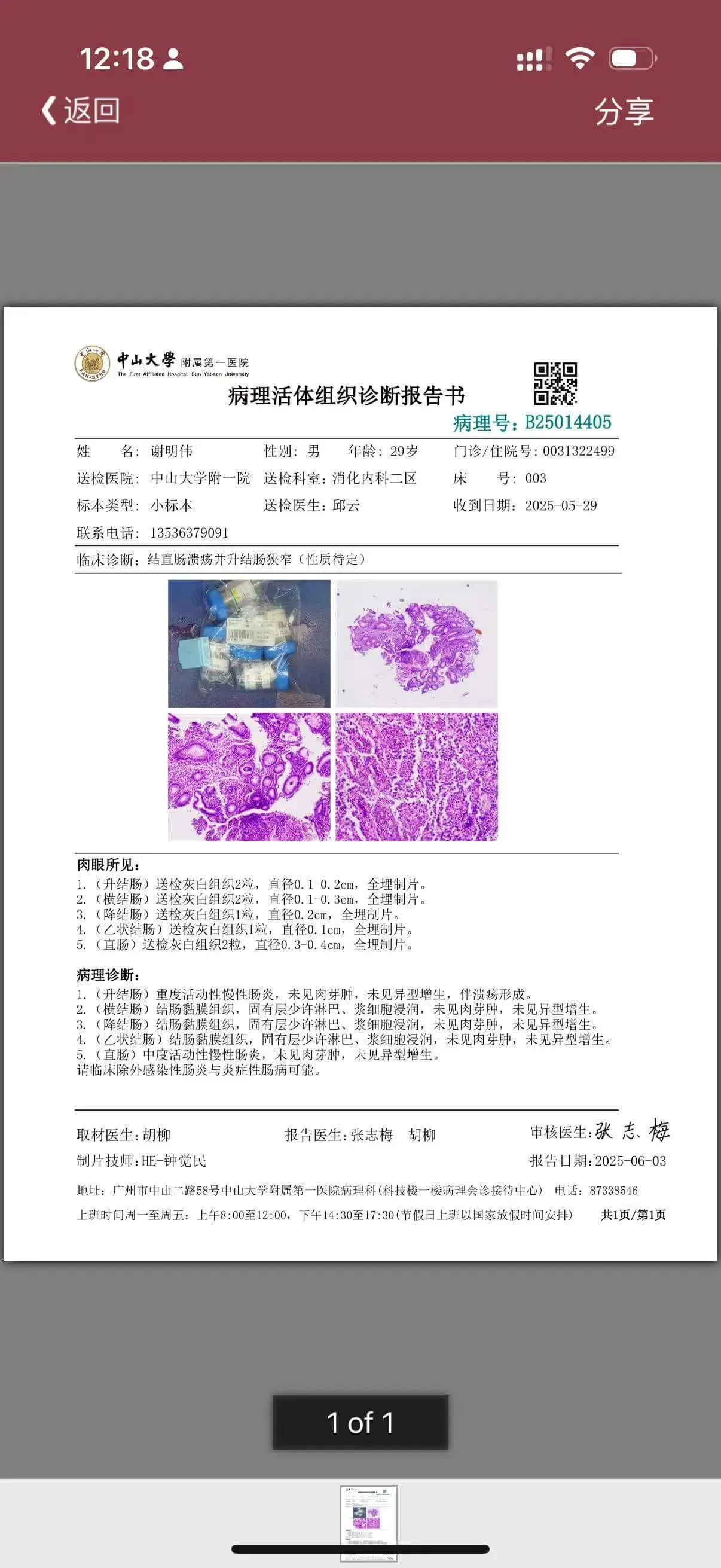 中山大学附属第一医院病理活体组织诊断报告